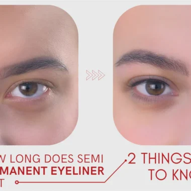 How Do You Get Rid of Beauty Marks: 9 Remedies [Natural]