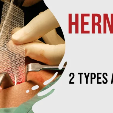 Common Minor Surgeries: Top 5 & Benefits with Risks