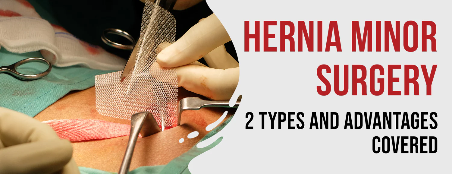 The two types of hernia surgery and their advantages
