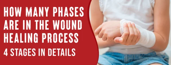 The wound healing process has four phases