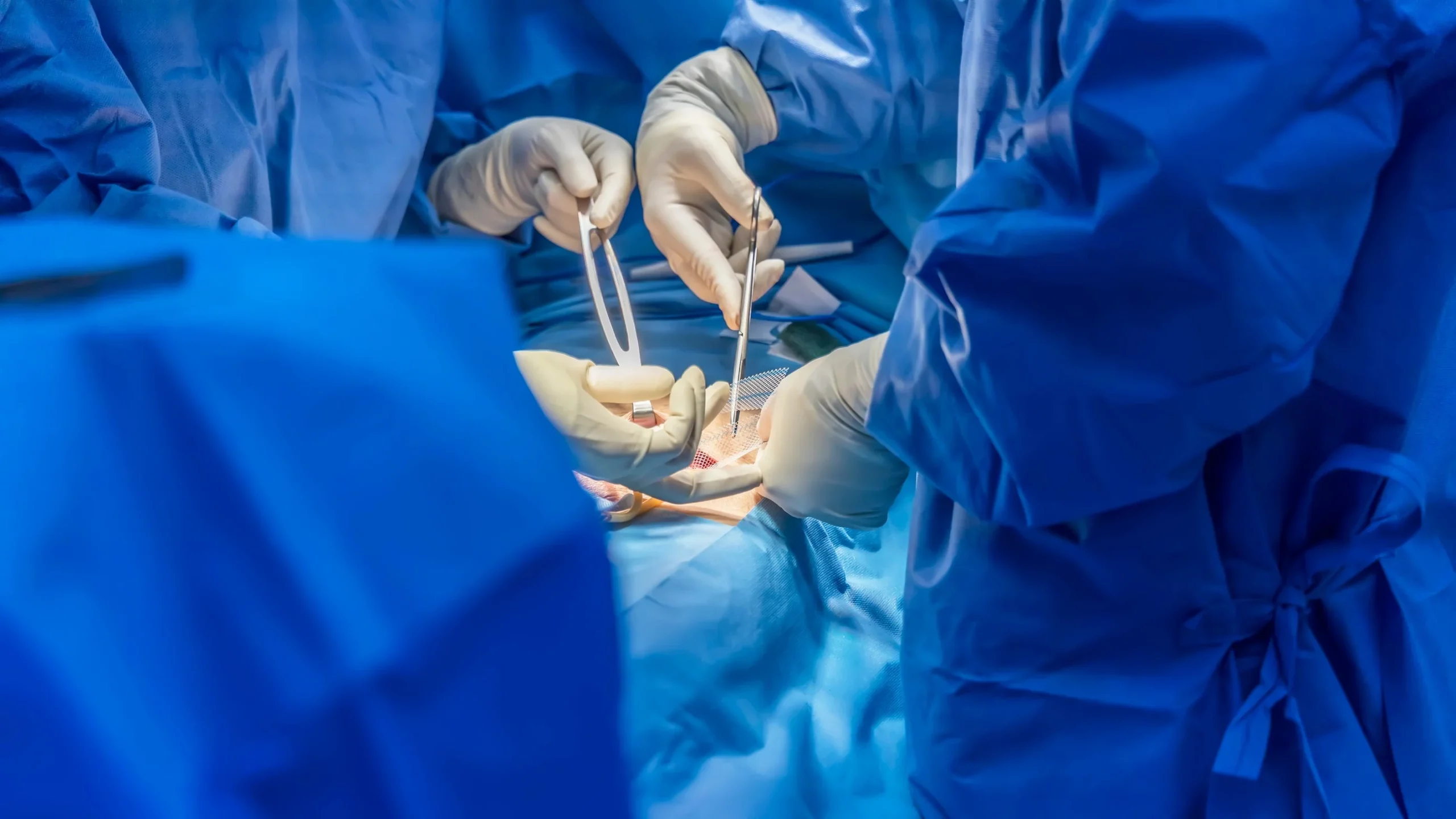 Types of hernia minor surgery