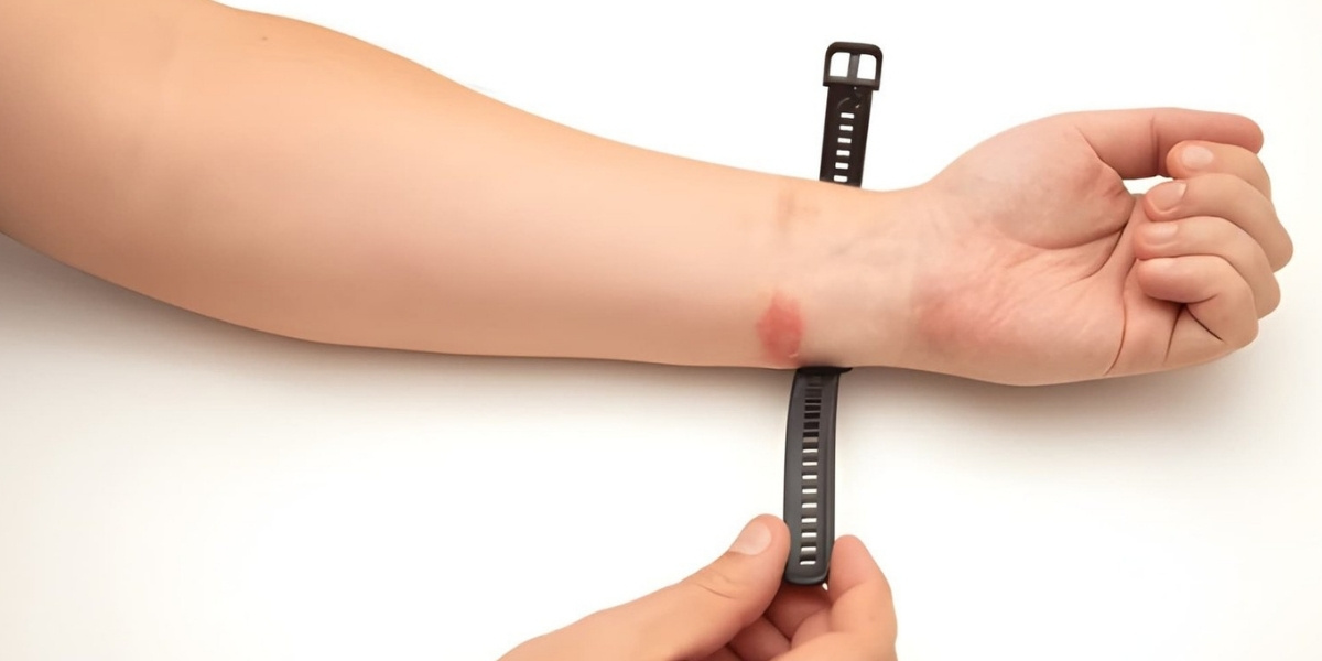 Allergies to the skin