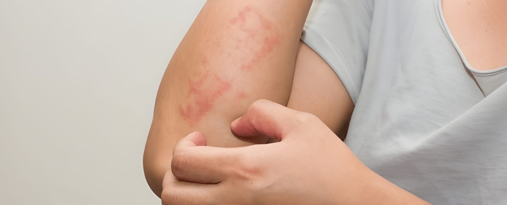 Identifying and preventing skin allergies caused by vitamin deficiency