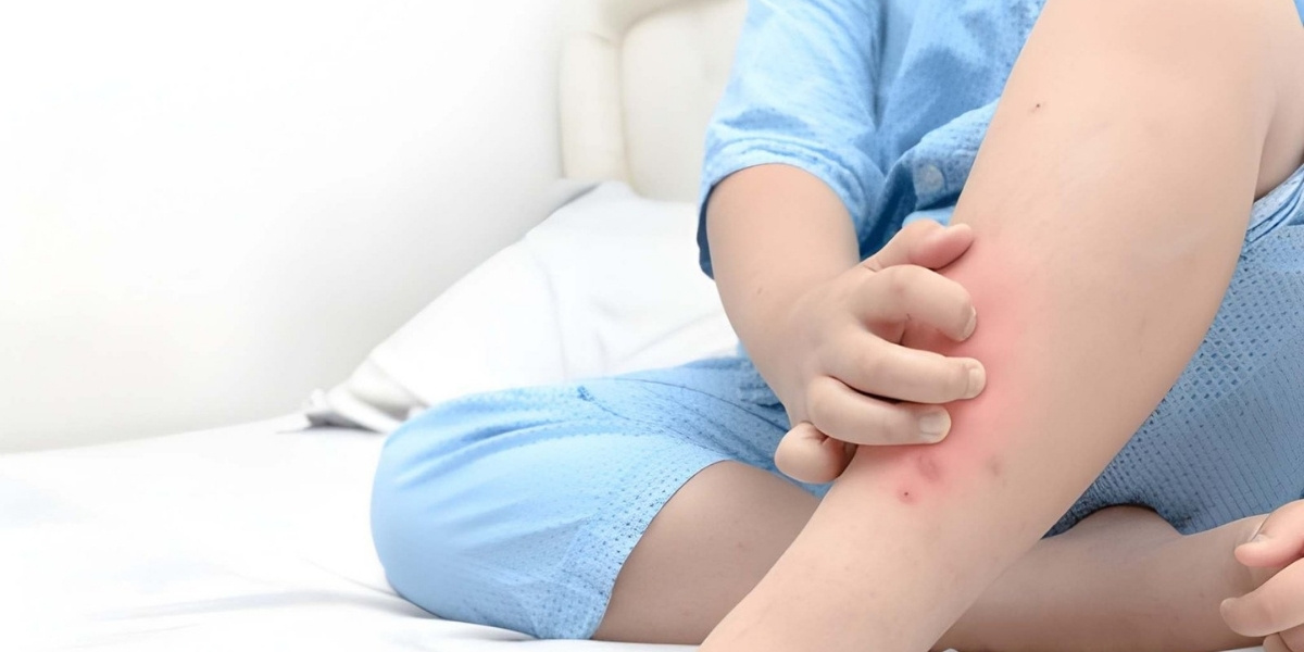 Managing and Treating Diabetes-Related Itching