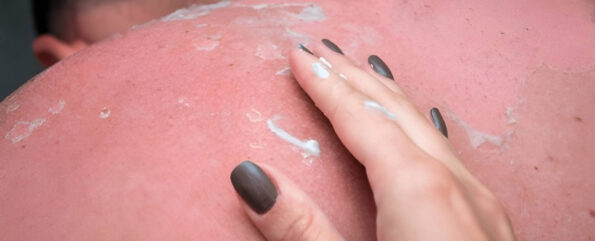 Preparation & Use of Salt Water for Itchy Skin