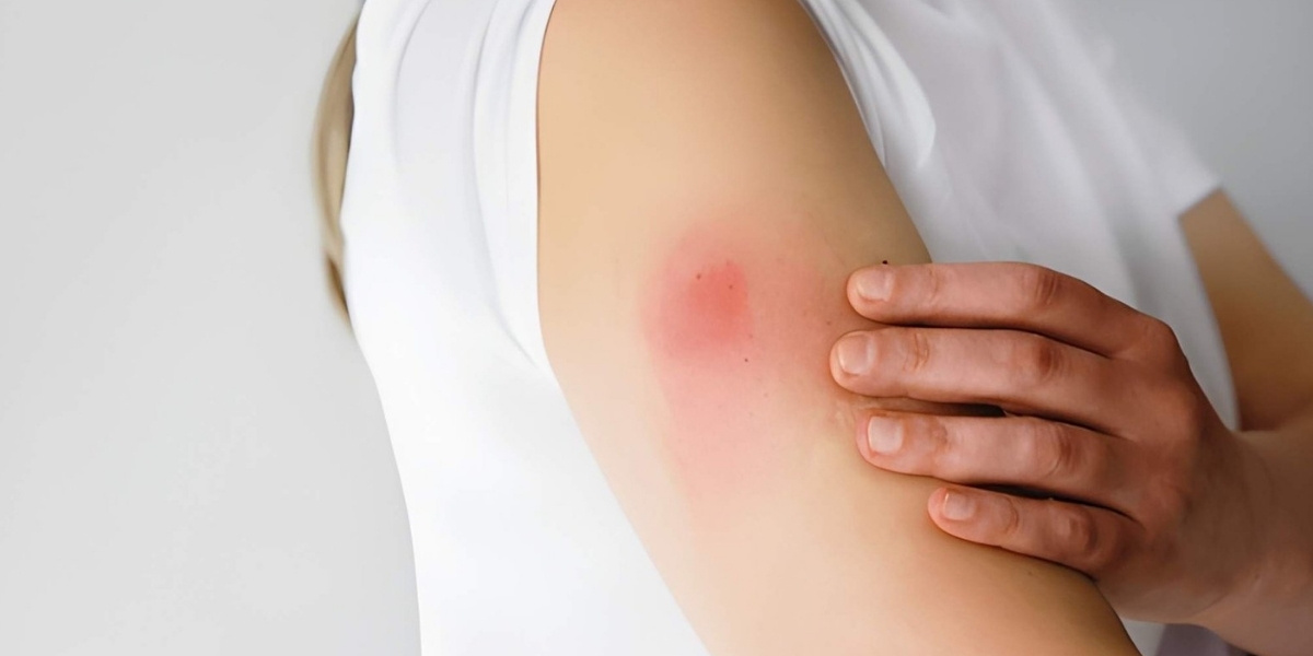 Side Effects of Allergy Shots for Adults