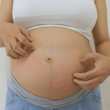 Can Menopause Cause Skin Allergies: 4 Causes [Explained in Steps]