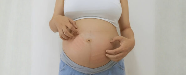 Skin Irritation During Pregnancy