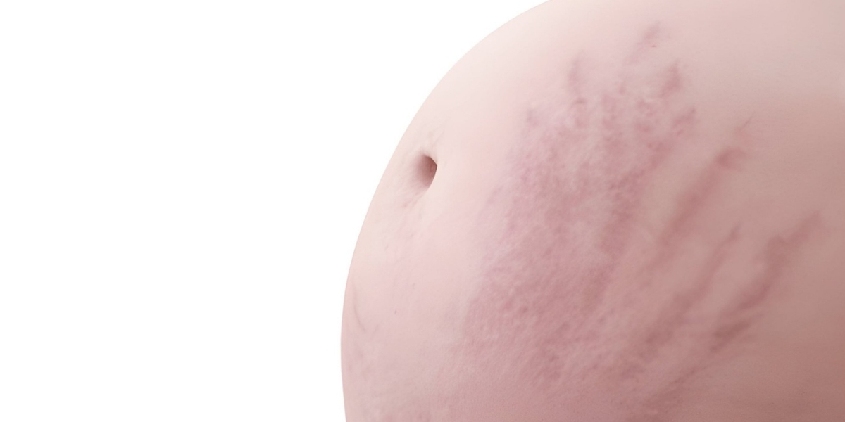 Skin Irritation During Pregnancy Common Conditions