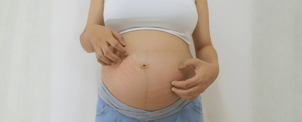 Skin Irritation During Pregnancy
