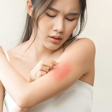 Which Ointment is Used For Skin Allergy: An In-Depth Analysis and 4 Factors