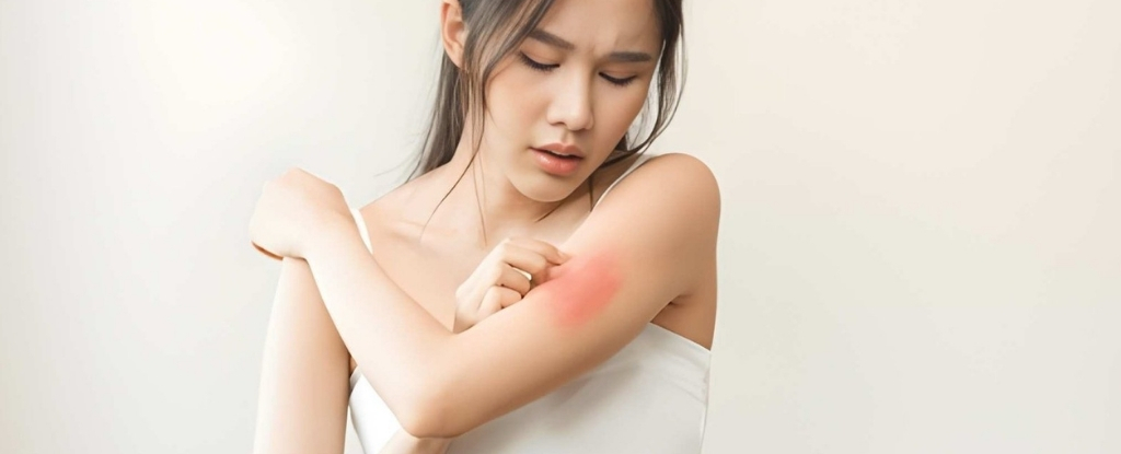 Symptoms & Treatments of Skin Allergies