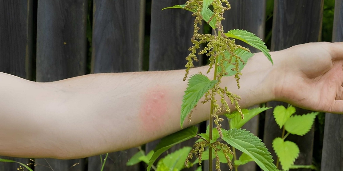 The stinging nettle