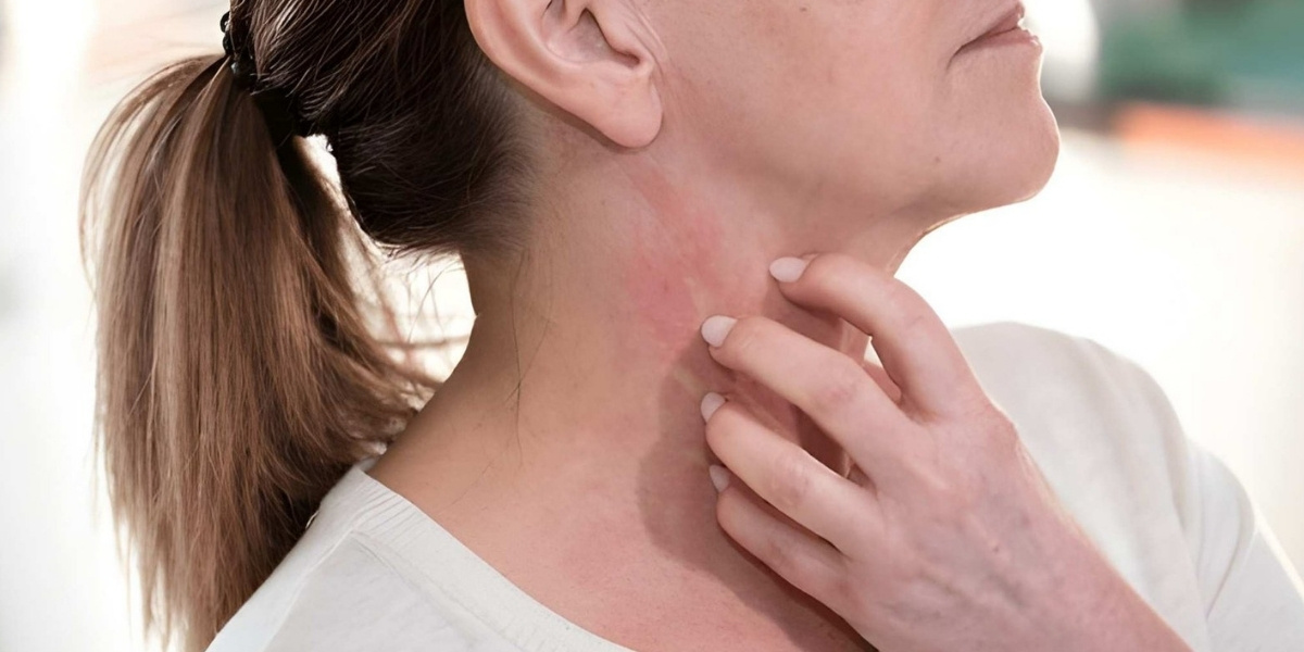 Understanding Menopause Skin Allergies