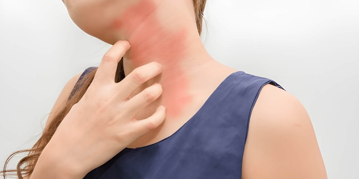 Vitamin Deficiency Associated with Skin Allergies