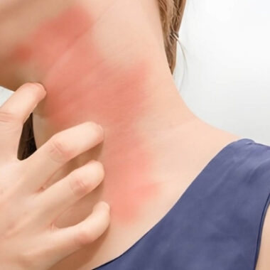 Can You Push A Prolapsed Hemorrhoid Back In | 5 Steps [DIY]