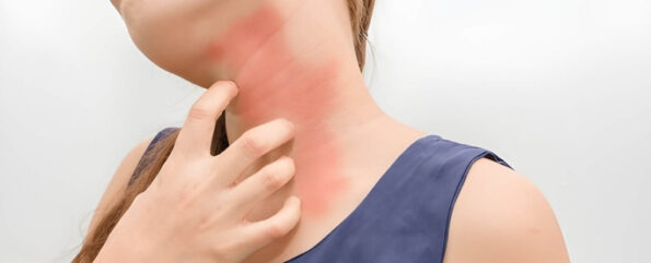 different types of cockroach allergy symptoms