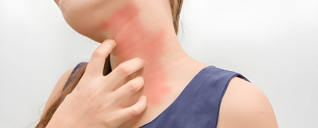 different types of cockroach allergy symptoms