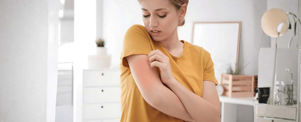 manage diabetes-related itching all over the body