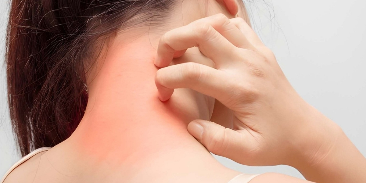 types of cockroach allergies